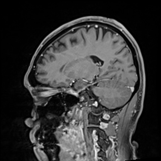 Click on the Serie image to view the images of VILLANUEVA, WILLIAM A.